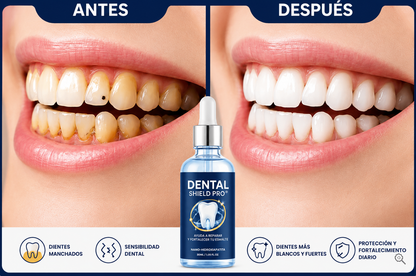 REPARADOR DE ESMALTE DENTAL TRUERELIEF ORIGINAL 🦷+ ENVIO GRATIS