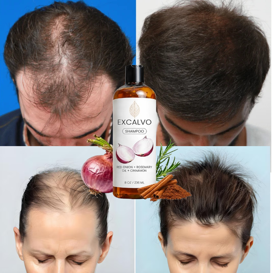 EXCALVO SHAMPOO 236ml